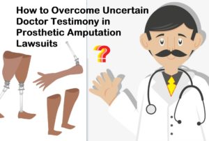 How to Overcome Uncertain Treating Physician Testimony in Prosthetic Amputation Lawsuits